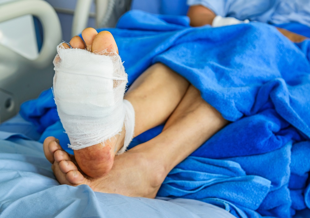Foot Surgery