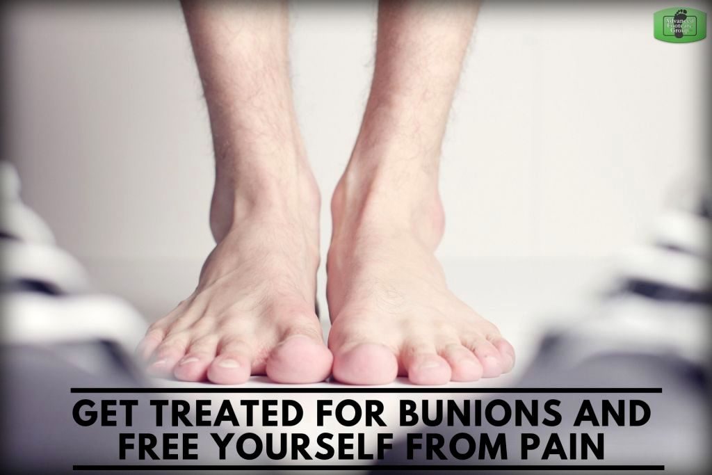 Bunion treatment